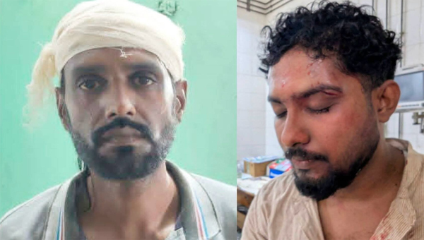 ওসমানী হাসপাতালে দুই সাংবাদিকের ওপর ইন্টার্ন চিকিৎসকদের হা'ম'লা ওসমানী হাসপাতালে দুই সাংবাদিকের ওপর ইন্টার্ন চিকিৎসকদের হা'ম'লা